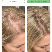 Orterra™ Rosmarin- und Reiswasser-Spray