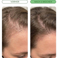 Orterra™ Rosmarin- und Reiswasser-Spray